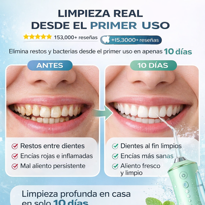 AquaDent™ | Irrigador Bucal